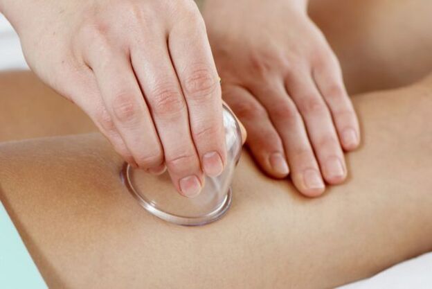 cupping massage para sa varicose veins