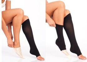 paglalagay ng compression stockings para sa varicose veins